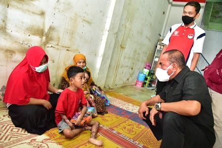 Dijenguk Gubsu, Dua Anak Penderita Penyakit Kulit Dirujuk ke Rs Haji Medan