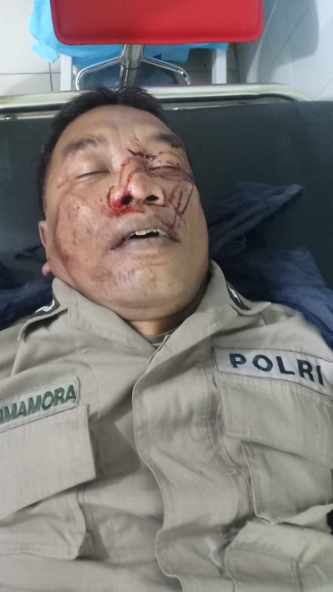 Diduga Mengalami Laka Tunggal Personil Polsek Medan Kota Meninggal Dunia