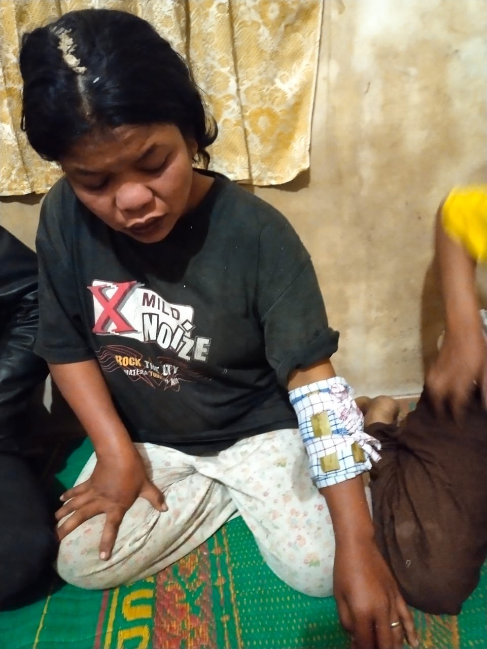 Polres Dairi Diminta Tangkap Pelaku Penganiayaan Ibu dan Anak di Dairi