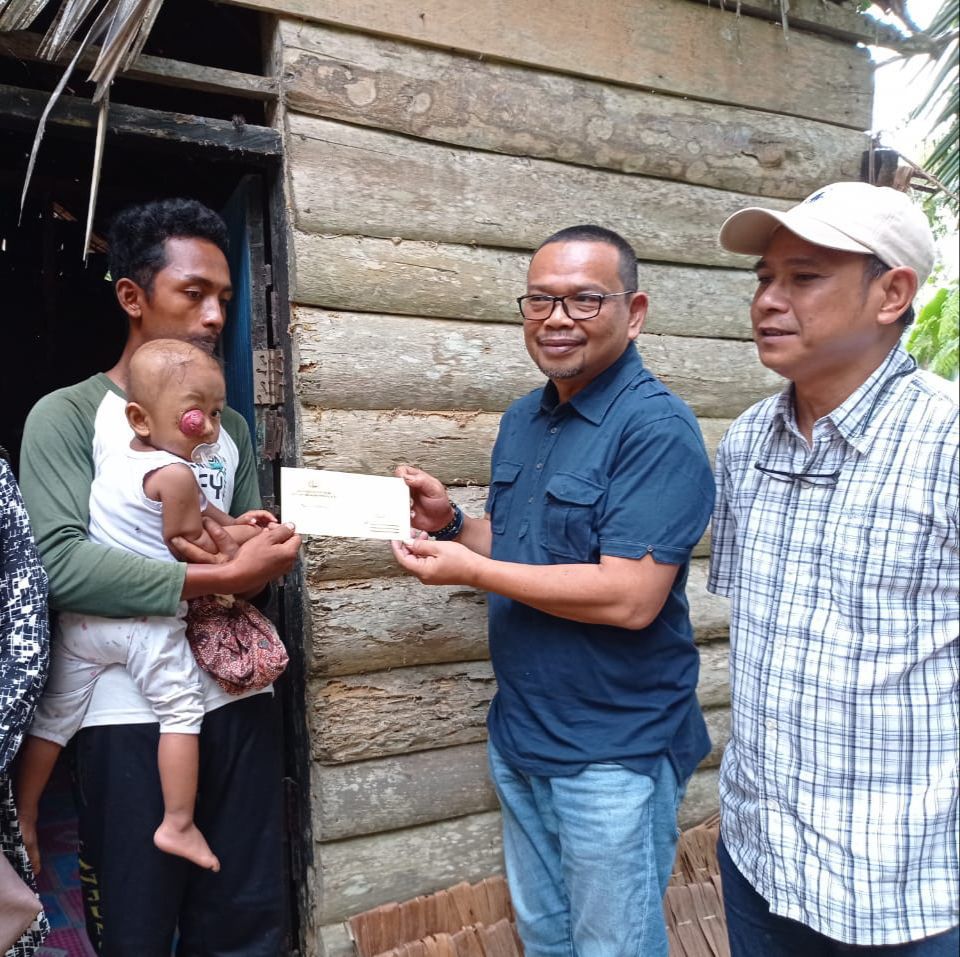 Sedulur Selawase Salurkan Bantuan Kapolres Langkat dan Donatur untuk Bocah Penderita Tumor Mata