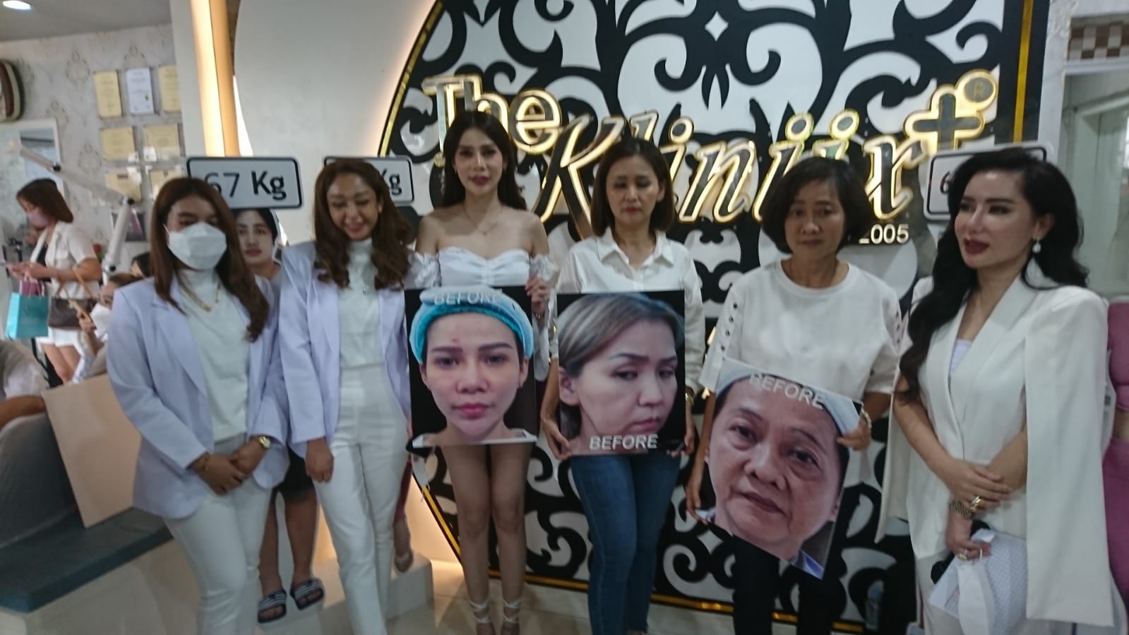 The Kliniix + Gelar Pameran Wajah, Venny Cio : Mau Cantik Tak Perlu Operasi Plastik dan ke Korea