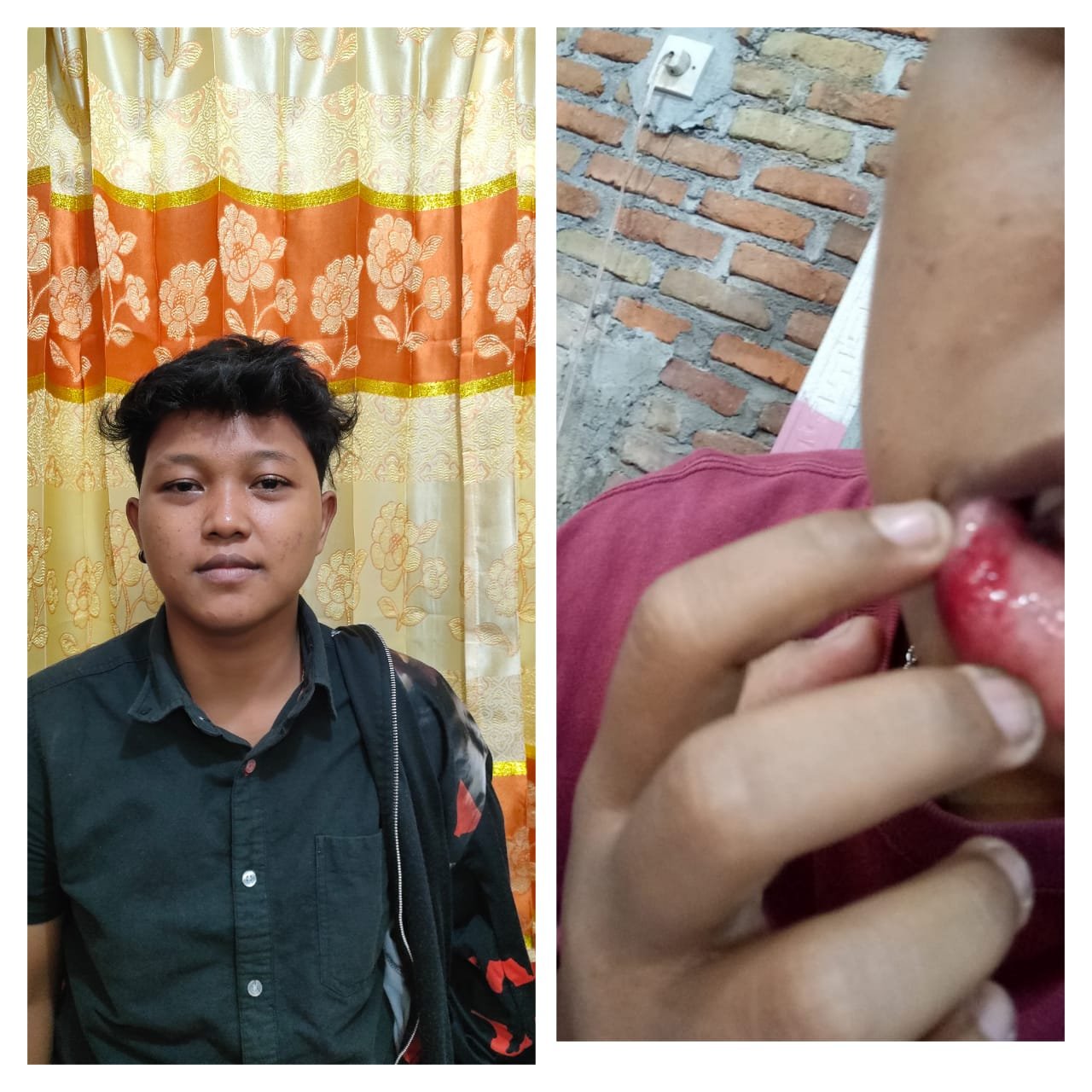 Bantah Anggotanya Terlibat Pengeroyokan, Joko Tarigan : Keluarga Residivis Itu yang Keroyok Anggota Kita Hingga Babak Belur