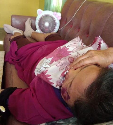 Isteri Redaktur Sumutposkota Dijambret Kondisi Luka-luka