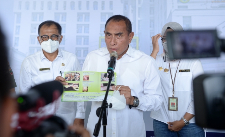 Gubernur Tegaskan Kasus PMK di Sumut Masih Terkendali