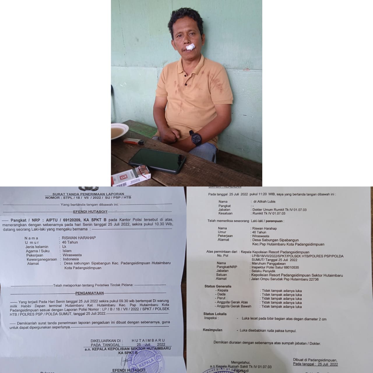 Ngeri! Ketua PAC Pemuda Pancasila Hutaimbaru Dipukul Secara Membabi Buta