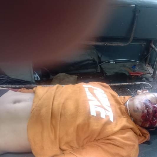 Sosok Pria Ditemukan Tewas di Toilet SPBU Simpang Marbau