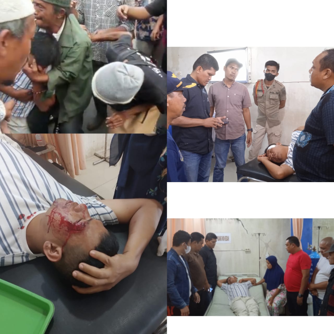 Kepala Anggota Satpol PP Pecah, Diduga Dipukul Benda Keras Dari Belakang Saat Penertiban PKL Jln Thamrin