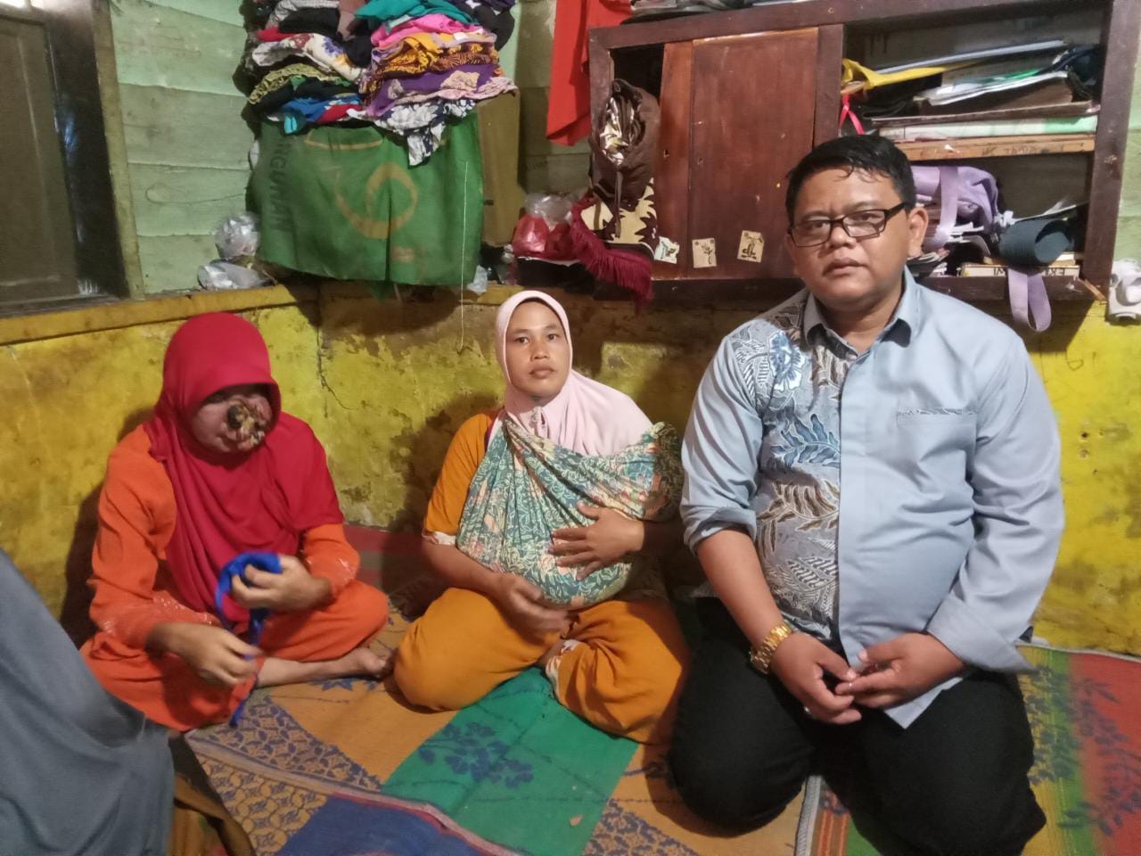 Usai Mendapat Info, Bupati Tapsel Dolly Pasaribu Sigap Bantu Warga Penderita Penyakit Kulit di Pargarutan Tonga