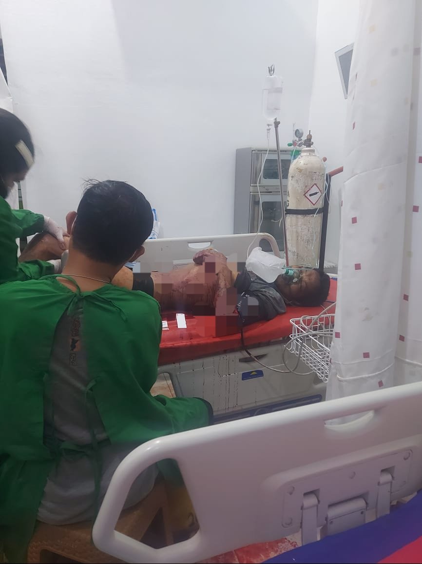 Tidak Terima Ditegur Berbahasa Kotor, Benyamin Bacok Sekjen Satgasus DPC LSM PAKAR Kabupaten Deliserdang