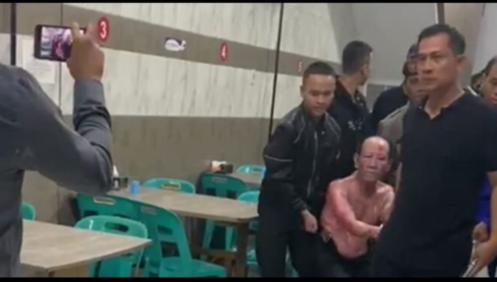 Percobaan Pembunuhan di Jln Skip Medan Baru Diduga Dilakukan Karena Sakit Hati