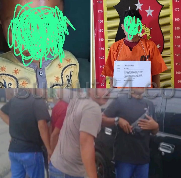 Diduga Istri Kabur, Anak Tiri Jadi Lampiasan hingga luka Memar di Padangsidimpuan, Ini Keterangan AKBP Dudung Setyawan