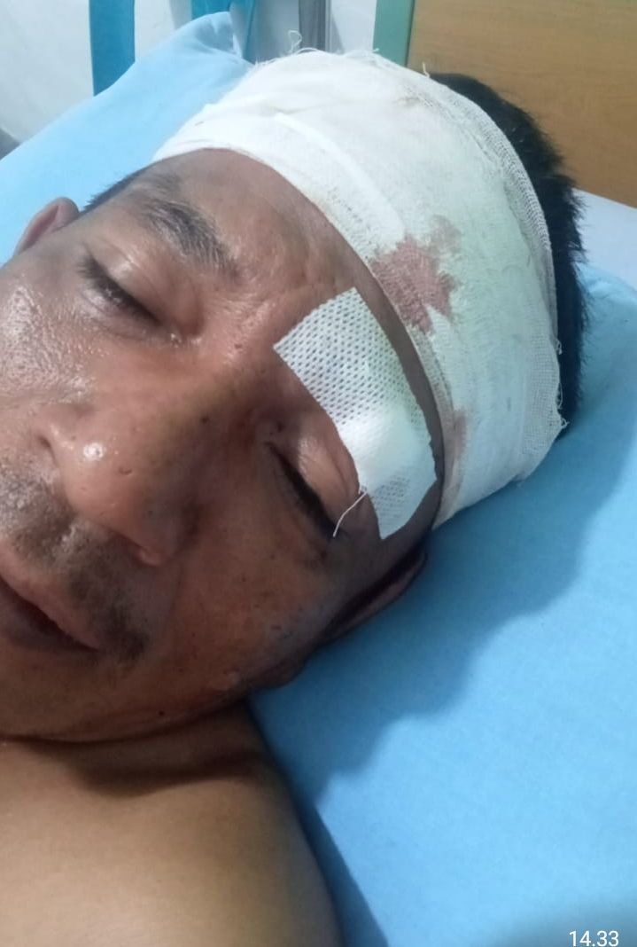 RS Ketua Mujana Pokkan Baru Aniaya Warga