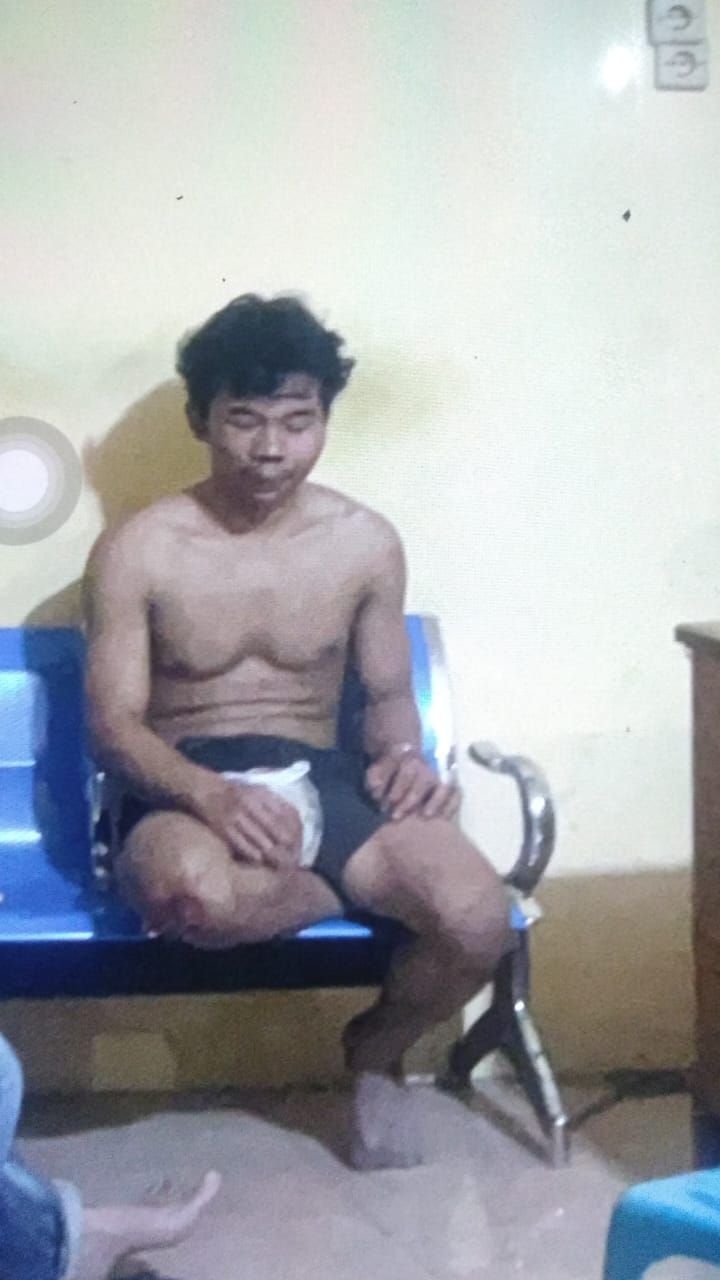 Modus Beli Beras, Pedagang Nyaris Tewas Dipukul Dua Perampok