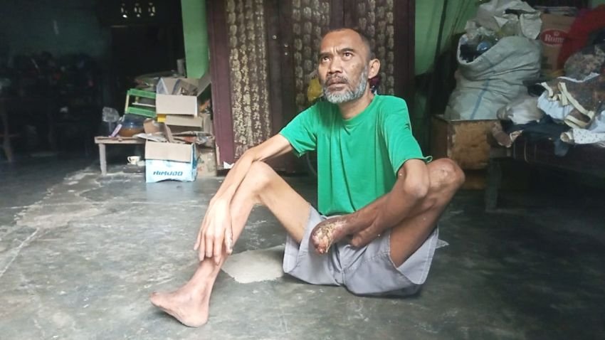 Butuh Bantuan Pemerintah,Seluruh Jari Kaki Terlepas dari Badan, Seniman dan Pelukis Kaligrafi di Pantai Labu