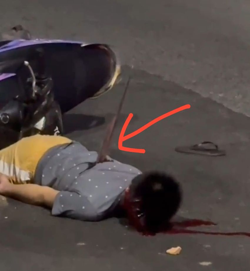 Diduga Tawuran Pemuda Kritis Tertusuk Pedang