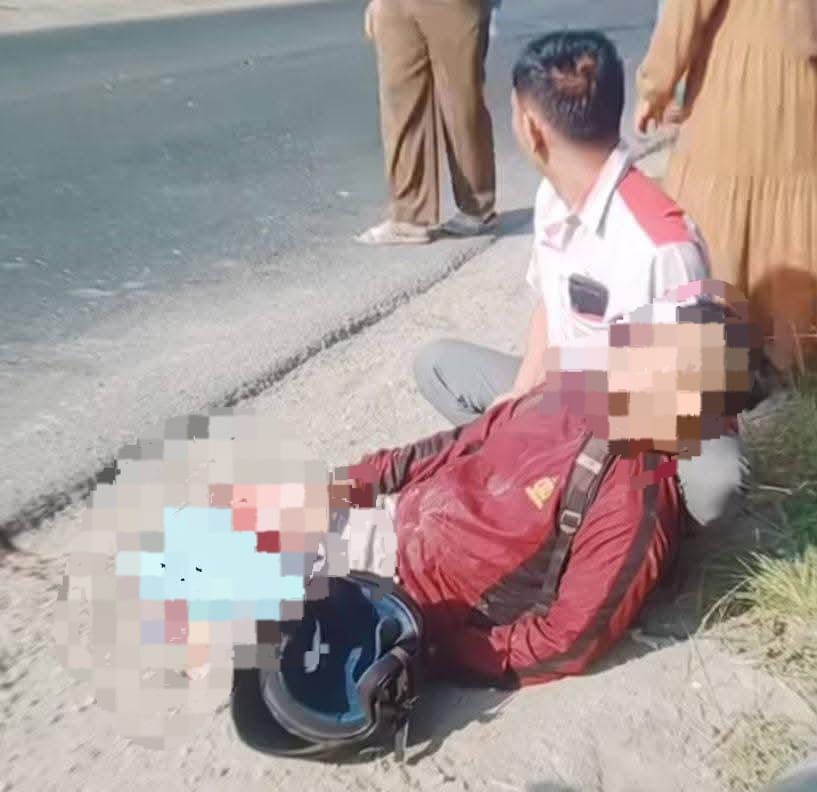 Truk Tronton Tabrak Pemotor di Jalinsum Perbaungan, Korban Patah Kaki, Sopir Kabur ke Arah Medan