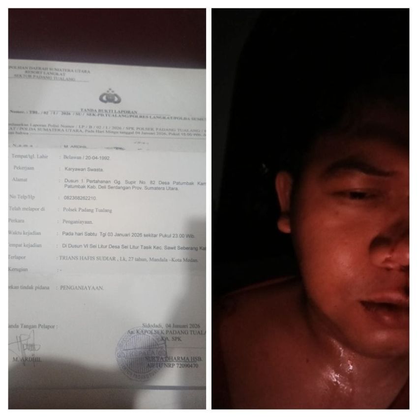 Ardi Korban Bullying dan Pengeroyokan Pacar Mantan Istri Dilapor Ke Polsek Padang Tualang