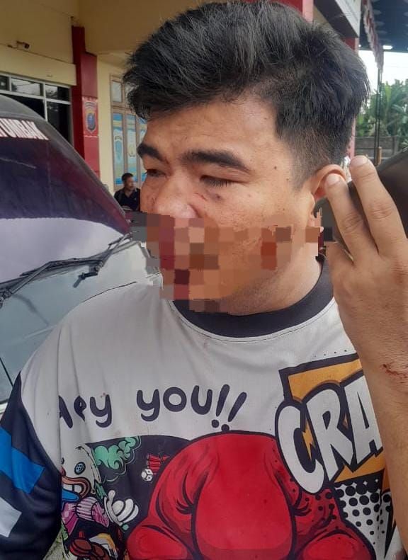 Tanpa Sebab, Erwin Dianiaya Kakak Beradik Ninok dan Nardi Hingga Bonyok