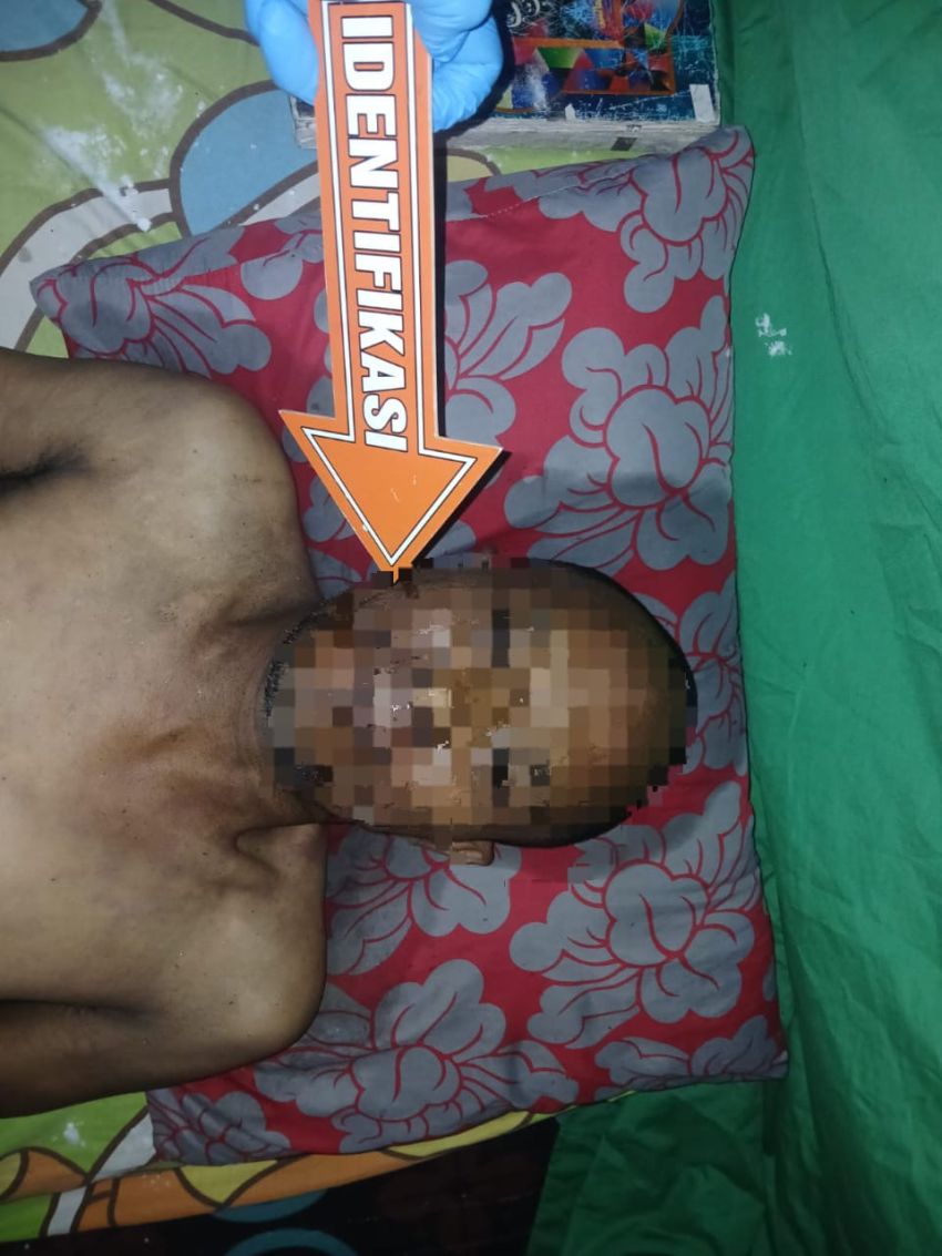 Mayat Pria Ditemukan di Pajak Baru Perbaungan, Polisi Pastikan Tidak Ada Tanda Kekerasan