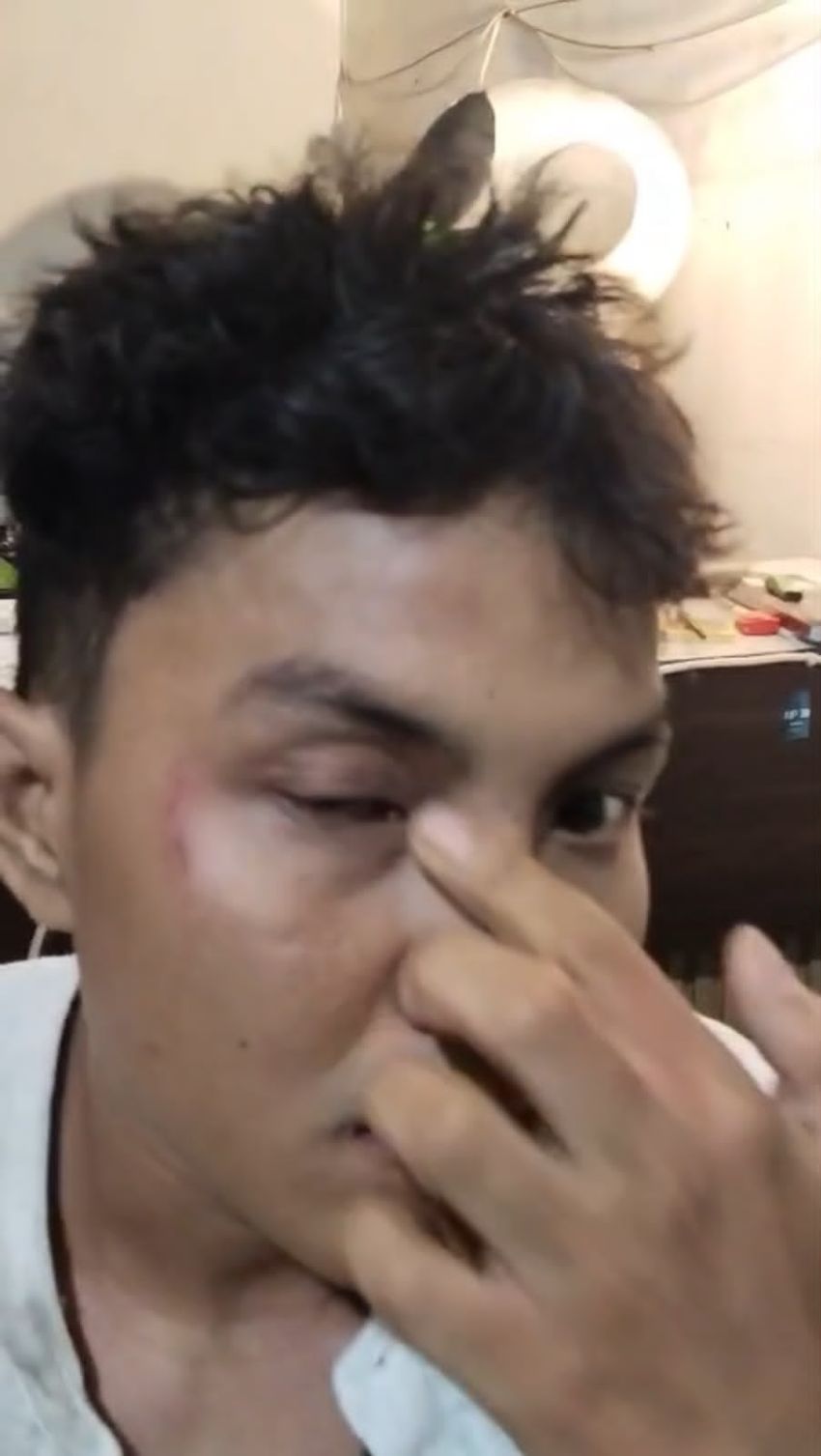 Sekap dan Aniaya Kader HMI di Kisaran, Bukti Lengkap Namun Laporan Polisi Belum Juga Bergerak